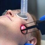 Latest Trends in CO2 Laser Treatments in Islamabad