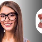 Understanding Braces Treatment: Options, Timeline and Results