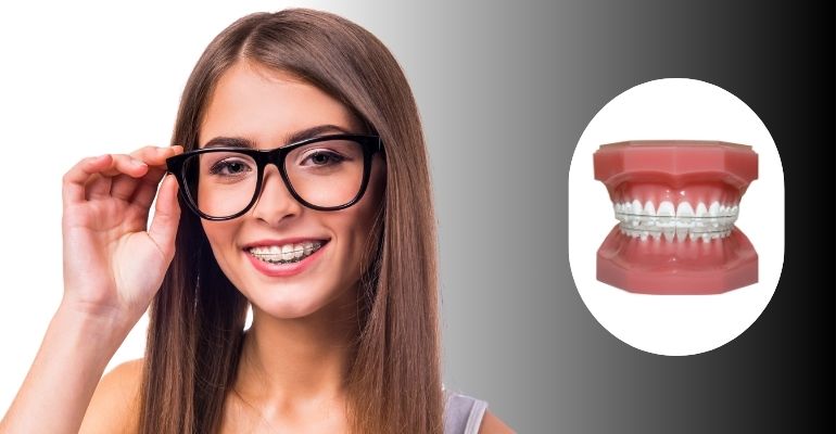 Understanding Braces Treatment: Options, Timeline and Results