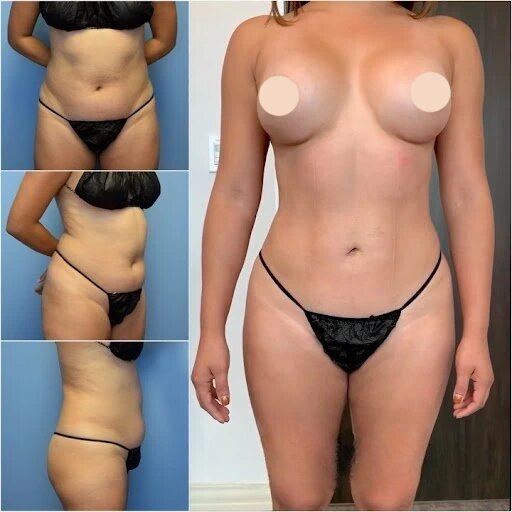 Best Doctors in Dubai for Precision Body Contouring