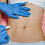 Intimate Area Fillers Dubai – Enhance Feminine Confidence