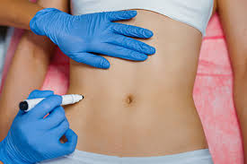 Intimate Area Fillers Dubai – Enhance Feminine Confidence