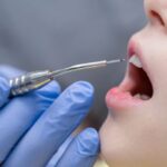 Laser Periodontal Treatment vs Traditional Gum Surgery