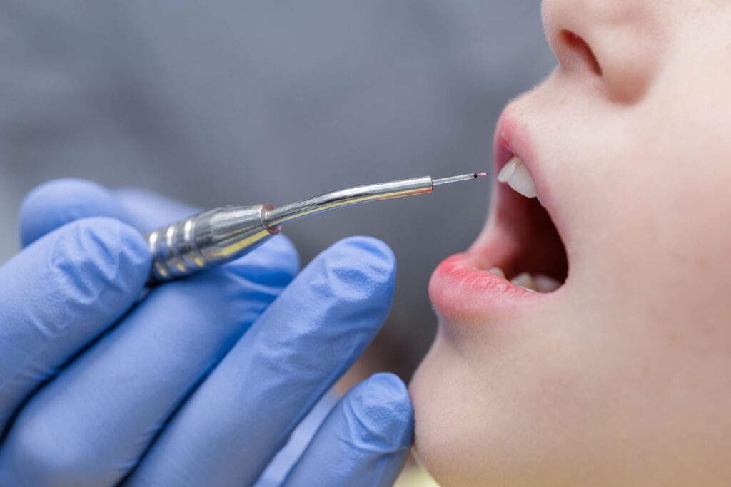 Laser Periodontal Treatment vs Traditional Gum Surgery