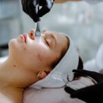 Why Your Acne Keeps Coming Back: Causes, Treatments & Long-Term Solutions