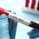 Discreet STD Test in Dubai: Quick & Easy Access