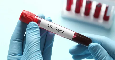 Discreet STD Test in Dubai: Quick & Easy Access