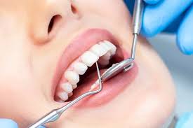 Can Root Canal Treatment in Scarborough Save Your Smile?