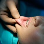 Common Orthodontic Problems Treated at an Orthodontic Clinic
