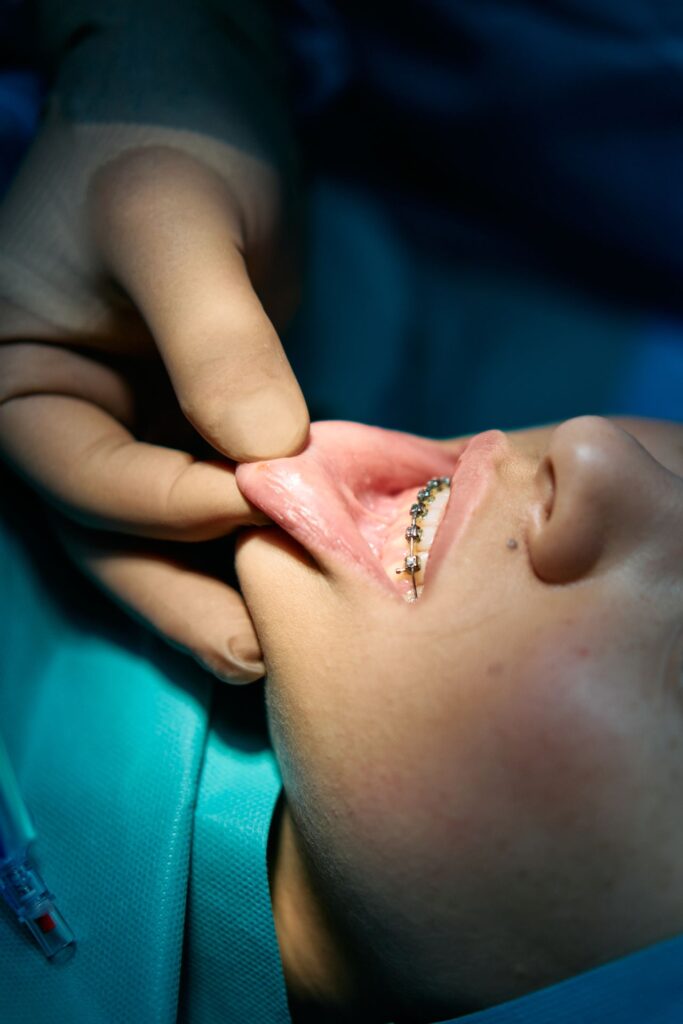 Common Orthodontic Problems Treated at an Orthodontic Clinic