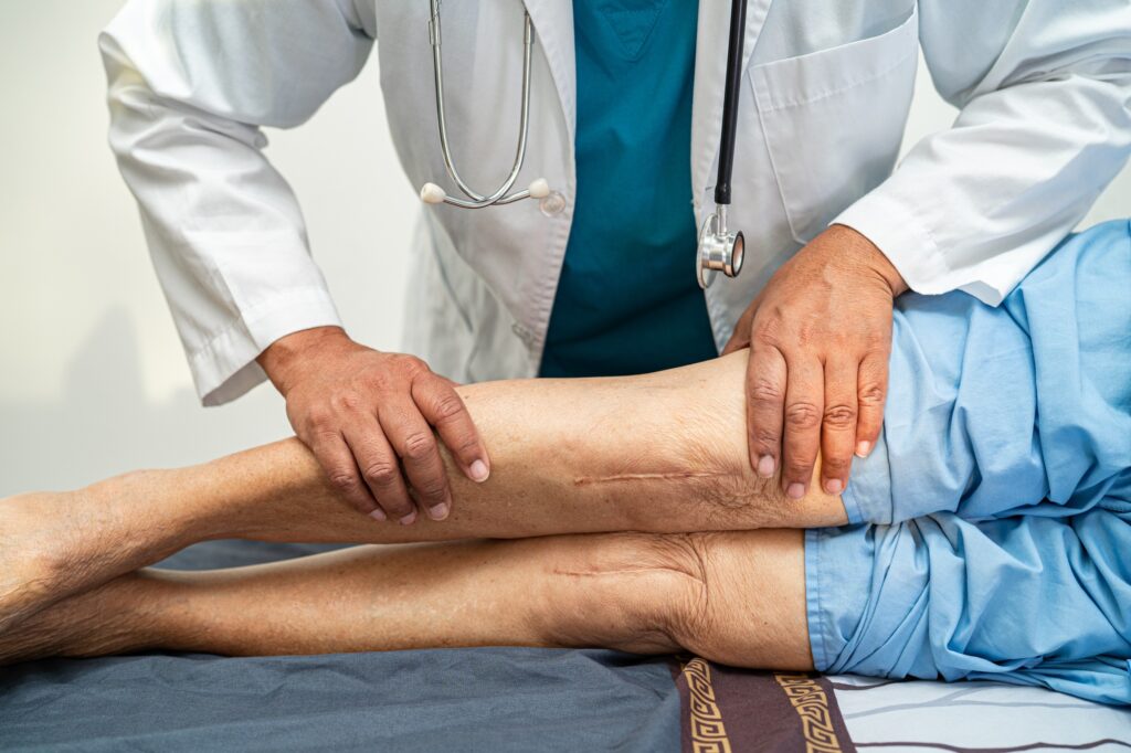 How Advanced Implant Materials Help Improve Mobility After Knee Replacement Surgery