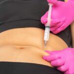 How Lipolysis Injection In Dubai Complements a Healthy Lifestyle