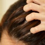 Best Anti-Dandruff and Hair Fall Control Shampoo for Healthy Hair