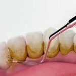 How Much Does Teeth Cleaning Cost in 2026?