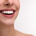 What Does a Smile Makeover Include? Understanding Your Treatment Options