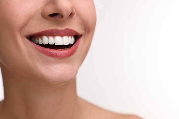 What Does a Smile Makeover Include? Understanding Your Treatment Options