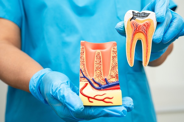 Is Single Sitting RCT Safe and Effective? Everything You Need to Know