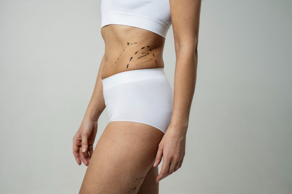 Take the Next Step Toward Body Confidence with the Best Liposuction Surgeon in Dubai