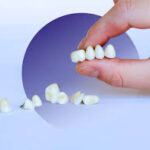 Damaged or Missing Teeth? How Crown & Bridges Treatment Can Help