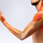 How to Manage Nerve Pain and Improve Comfort