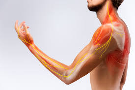 How to Manage Nerve Pain and Improve Comfort