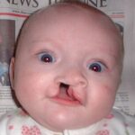 Congenital Anomalies in Dubai: Essential Pediatric Support