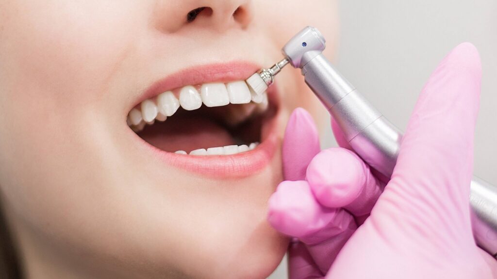 Teeth Cleaning Cost in Bhandara: What Affects Pricing and Patient Expenses