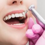 Teeth Cleaning Cost in Bhandara: What Affects Pricing and Patient Expenses