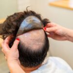 How To Buy Best Toupee for Men Online