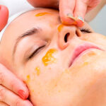 Why Are More People Choosing Inno Peel Treatments?