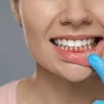 Is Gum Disease Reversible? Here’s What Dentists Say