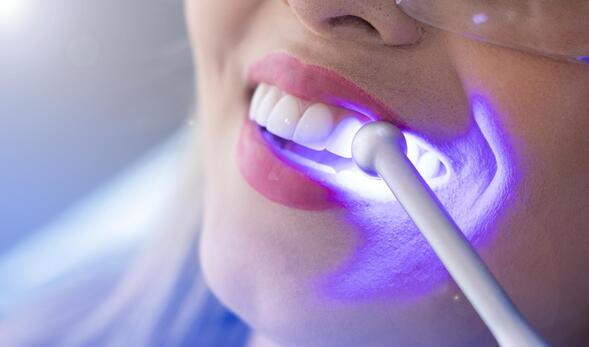 Laser Teeth Whitening Myths, Aftercare & Long-Term Maintenance: What You Really Need to Know