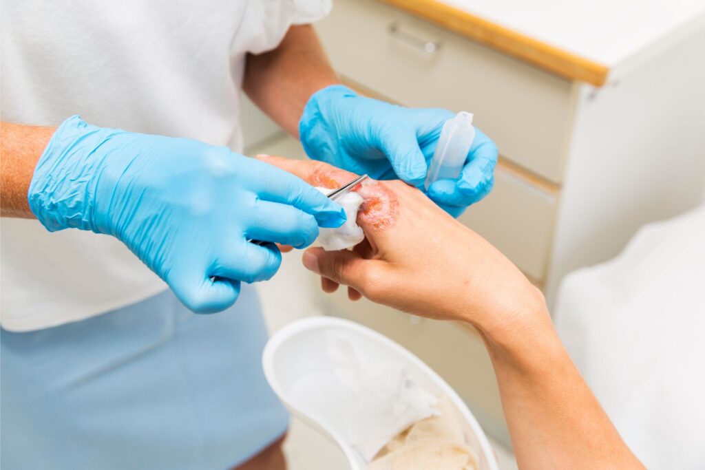 Role of Technology in Modern Wound Dressing at Home Care