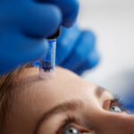 Questions to Ask Before Booking Skinpen Microneedling in Altrincham