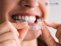 How Invisible Braces Can Transform Your Smile Without Metal Brackets