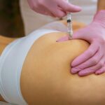 Are Butt Fillers Right for Achieving Balanced Curves?
