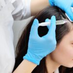 Why PRP Hair Treatment in Dubai Is Popular for Hair Thinning
