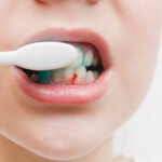 Bleeding Gums Every Time You Brush? Here’s What It Could Mean