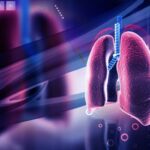 Early Detection and Cardiac Sarcoidosis Treatment: Why Timing Matters