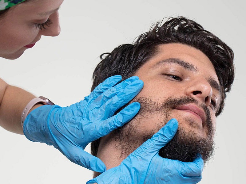 The Science Behind Natural Beard Hair Implantation Techniques