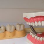 Are Implant Dentures the Best Solution at Rancho Cucamonga Dentistry?