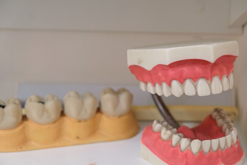 Are Implant Dentures the Best Solution at Rancho Cucamonga Dentistry?