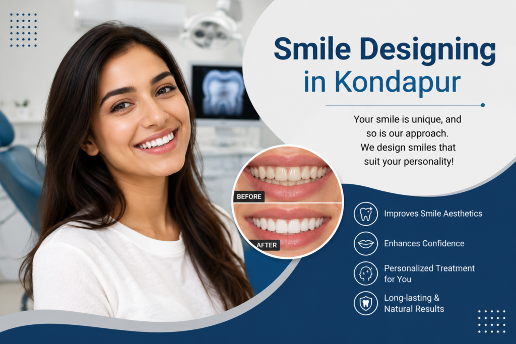 Smile Designing in Kondapur – Enhance Your Confidence with a Beautiful Smile