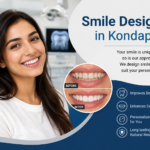 Smile Designing in Kondapur – Enhance Your Confidence with a Beautiful Smile