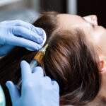 PRP Hair Treatment: Natural Hair Regrowth Solution in Riyadh