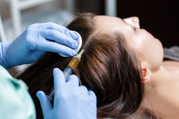 PRP Hair Treatment: Natural Hair Regrowth Solution in Riyadh