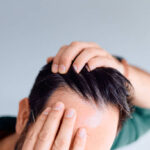 How Innovative Exosome Treatments Are Changing Hair Loss Solutions