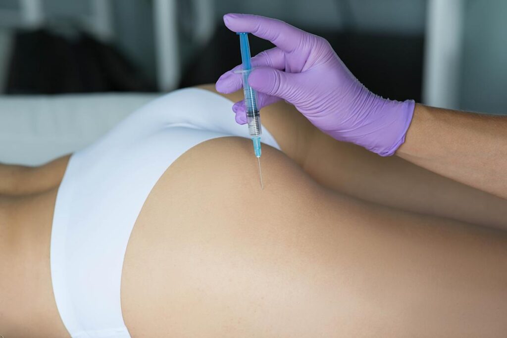 How Do Butt Fillers Improve Shape Without Surgery?