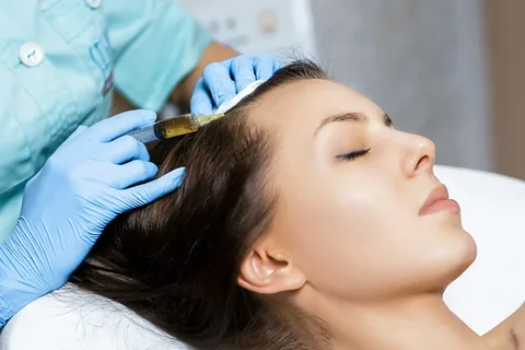 Revitalize Your Scalp: PRP Hair Treatment in Dubai