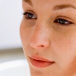 Can Large Pores Treatment Help Prevent Breakouts?